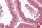 CTHRC1 Antibody (C-Terminus)
