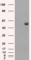 FH / Fumarase / MCL Antibody (clone 9G4)