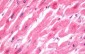 VDAC1 / PORIN Antibody