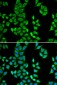 APCS / Serum Amyloid P / SAP Antibody