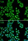 APCS / Serum Amyloid P / SAP Antibody