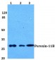 PEX11B Antibody (aa132-177)