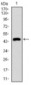 KRT5 / CK5 / Cytokeratin 5 Antibody (aa316-590, clone 2C2B4)