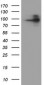 FOLH1 / PSMA Antibody (clone 3H5)