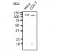 CDH1 / E Cadherin Antibody