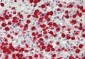 HRS / HGS Antibody (aa461-510)