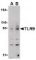 TLR9 Antibody (C-Terminus)