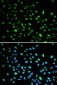 DDIT3 / CHOP Antibody