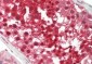 PSMB5 Antibody