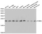 PSMB5 Antibody