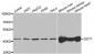 Aspartate Aminotransferase Antibody