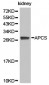 APCS / Serum Amyloid P / SAP Antibody