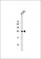 RAB27A Antibody