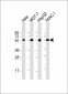 PDIA1 Antibody