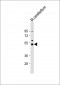 Dnmt2 Antibody