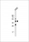 VEGF3 Antibody (N-term)