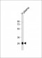 CFD Antibody (N-term)