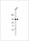 CDH3 Antibody (N-term)