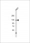 CDH3 Antibody (C-term)