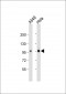 NR3C1 Antibody (C-term)