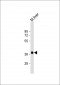 EI24 Antibody (N-Term)