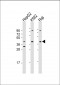 FGFR1OP Antibody (Center)