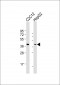 TFDP1 Antibody (N-Term)