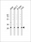 ACBD4 Antibody (Center)