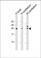 KCTD11 Antibody (N-Term)