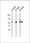 CDH13 Antibody (Center)