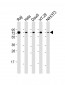 KHDRBS1 Antibody (Center)