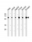 PGM1 Antibody (Center)