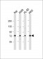 SKI Antibody (N-Term)