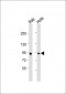 MYBL2 Antibody (Center)