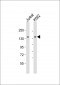 TACC3 Antibody (Center)