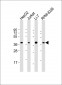 ARHGEF39 Antibody (Center)