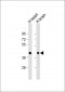 BRCC3 Antibody (N-Term)