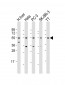 THRB Antibody (N-Term)