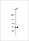 ZDHHC17 Antibody (N-Term)