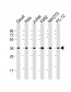 IKB alpha (IKBA) Antibody