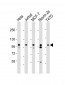 EZH2 Antibody