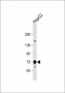 CPT2 Antibody (N-term)