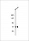 CPT2 Antibody (N-term)