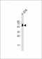 Vimentin Antibody (C-term)