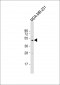 MMP13 Antibody (C-term)