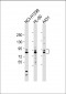 MMP9 Antibody (C-term)