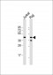 CD82 (ST6) Antibody (C-term)