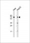 ZBTB7B Antibody (C-term)