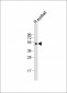 PAX6-T373 Antibody