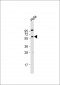 AKT2 Antibody (N-term)